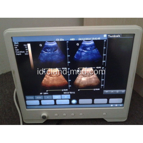 Portable Ultrasound Scanner Digital Ultrasound Machine Harga